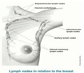 10 The Importance of the Lymphatic System The lymphatic system is important to understand as it is one way that breast cancers can spread.
