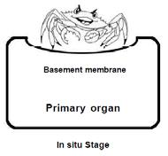What Does In-Situ Mean? In-Situ is defined as malignancy without invasion Only occurs with epithelial or mucosal tissue Must be microscopically diagnosed to visualize the basement membrane.