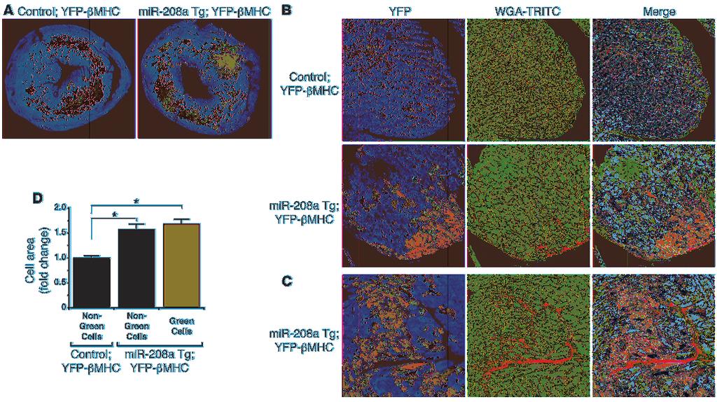 research article Figure 4 Distribution of YFP-βMHC fusion protein in mir-208a Tg hearts. (A) Confocal fluorescent images of coronal sections from control and mir-208a Tg hearts.