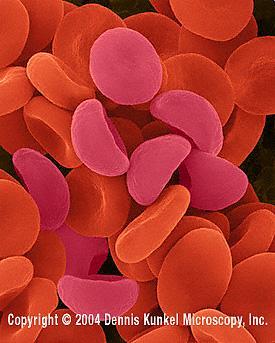 Red blood cells in hypotonic solution X 1000 Note that the pinkish cells have