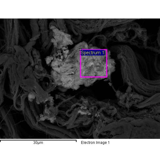 4 a) SEM Image of Phosphorus-Based Calcium Mineralization in GA-fixed BP b) Image