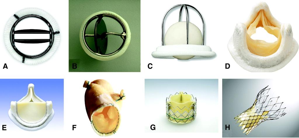 14 development of tissue engineered heart valves and though there may seem to be promising results, there is still a long way to go before tissue-engineered valves become common practice. Figure 2.