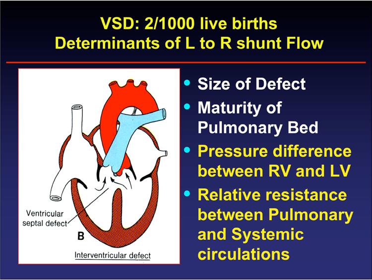 Small (restrictive) VSD: L to R shunt flow limited by size of hole Large (unrestrictive) VSD: L to R shunt flow is