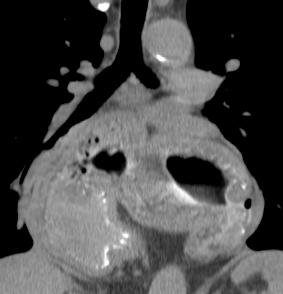54-old-year old male patient with chest pain