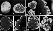 Leptin STAT3 (J-L) Bcl-X (M-O) TGFb2 Antezak and Van Blerkom, Human Reprod, 14, 429-447, 1999 Embryo asymmetry Human embryos shows asymmetric distribution of factors believed to be important for