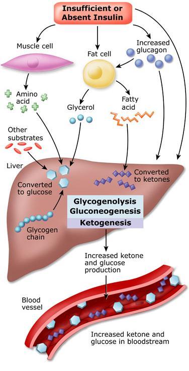 Insufficient cellular glucose to maintain energy stores Adipose tissue breaks down fatty acids Liver converts fatty acids to ketone bodies as alternative energy