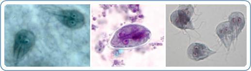 The CDC estimates about 77,000 cases of giardiasis each year in the United States (2010 ~ 20.000 cases reported) CDC DPDM 1.