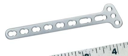 Small Fragment Locking Compression Plate (LCP) System The aim of any surgical fracture treatment is to reconstruct the anatomy and restore its function.