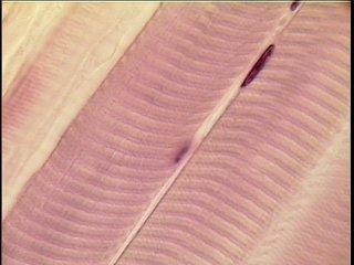 Skeletal Muscle Tissue Packaged in skeletal muscles that attach to and cover the bony skeleton Has obvious stripes called striations Is controlled voluntarily (i.e., by conscious