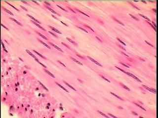 Smooth Muscle Tissue Found in the walls of hollow visceral organs, such as the stomach, urinary bladder, and