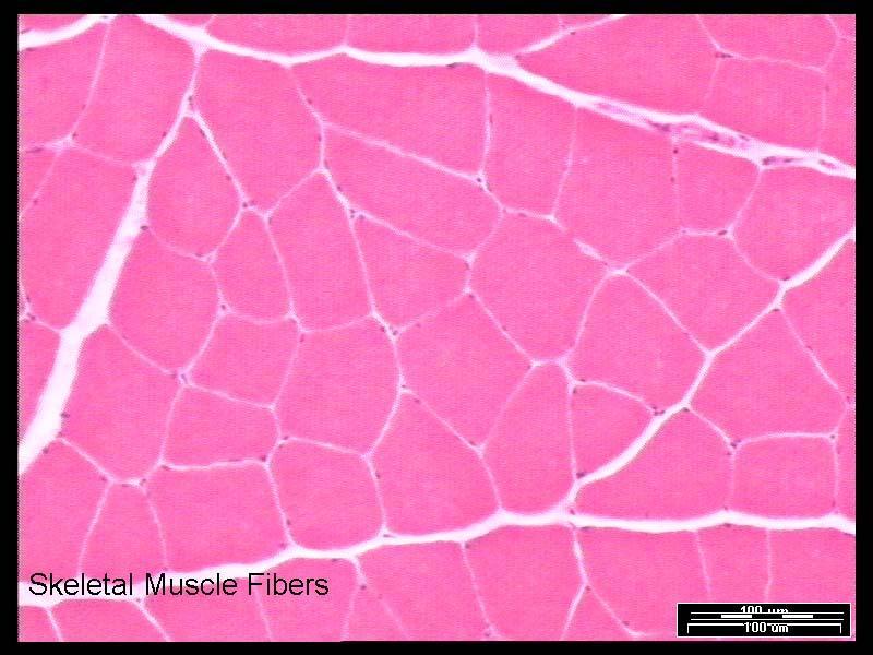 Skeletal muscle fibres The connective tissue coatings : Endomysium perimysium and