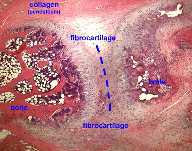 Low mag of fibrocartilage