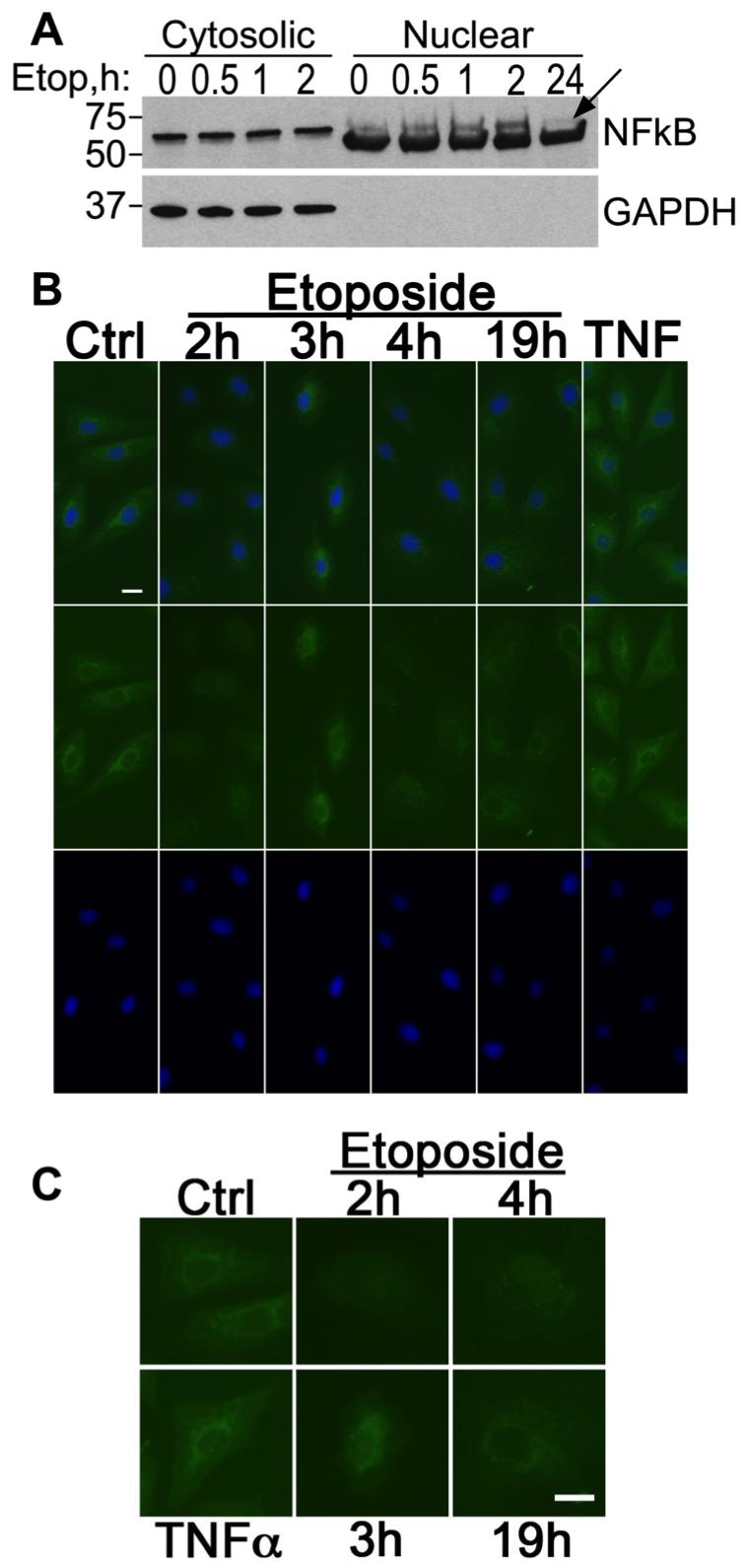 Supplementary Figure S4 Supplementary Figure S4: Etoposide induces nuclear translocation of NFκB in UW228 medulloblastoma cells.