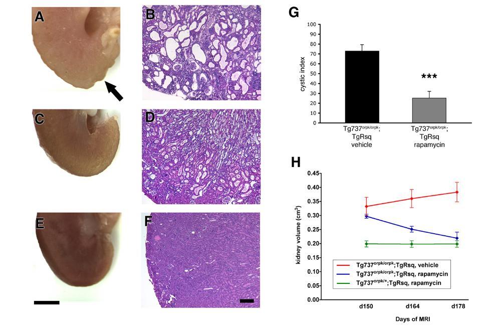 The mtor inhibitor rapamycin reduces cysts in the orpk rescue rescue mouse model Rapamycin treated mutant mouse
