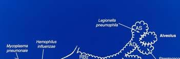Etiology of Pneumonia CAP Streptococcus pneumoniae (30-60%) Haemophilus influenza Staphylococcus aureus Klebsiella,
