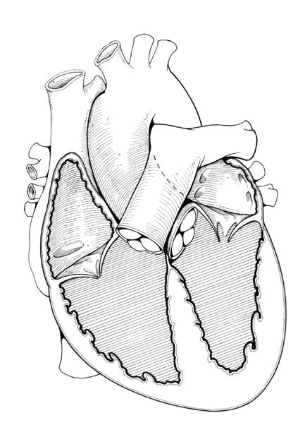 What are the options in heart valve replacement?