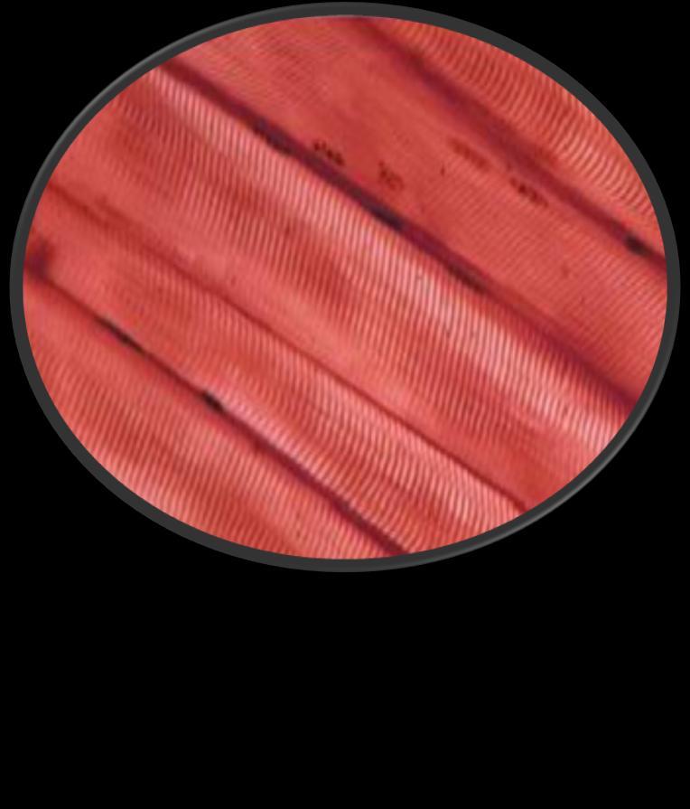 Skeletal Muscle Nuclei Striations 400X (High Power) Move your bones (also your face, eyes etc) Voluntary (you can control them) Over 400