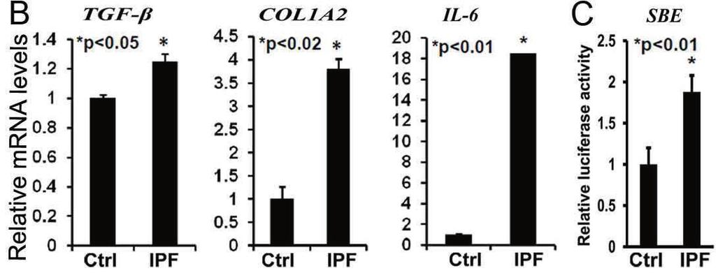 The activity of firefly luciferase was measured in cell lysates and normalized to the activity of renilla luciferase. E.V-empty vector. Co: control, IPF: idiopathic pulmonary fibrosis.