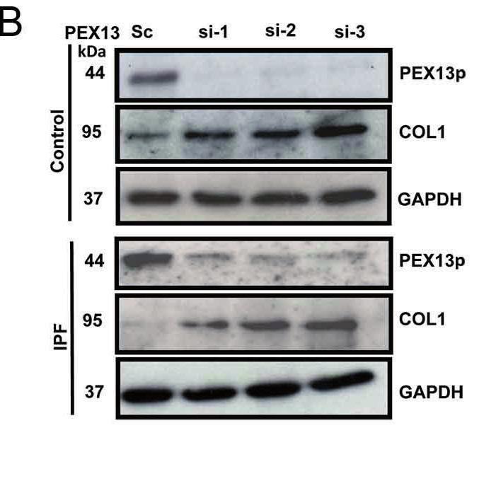 Fig. 14. Increased fibrotic response in PEX13 sirna treated control and IPF fibroblasts.