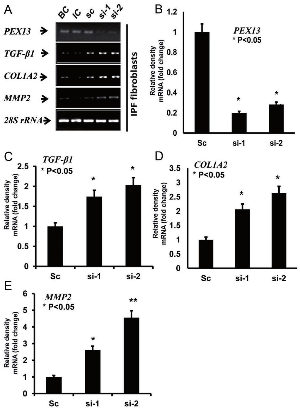Fig. 17. Increased fibrotic response and elevated MMP2 mrna in PEX13 knockdown of IPF fibroblasts. (A) Expression of PEX13, TGF- 1, COL1A2 and MMP2 at mrna level shown by RT-PCR in IPF fibroblasts.
