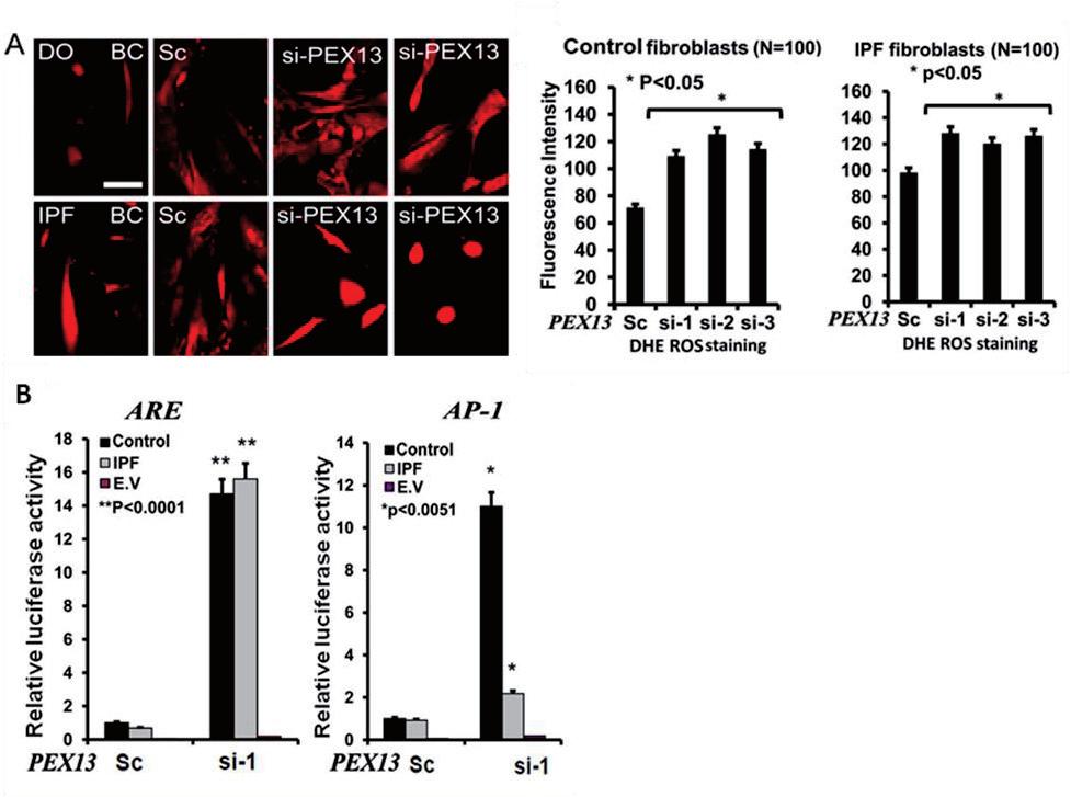 Fig. 18. Induction of ROS and activation of ARE, AP1 transcriptional elements in PEX13 knockdown control and IPF fibroblasts.