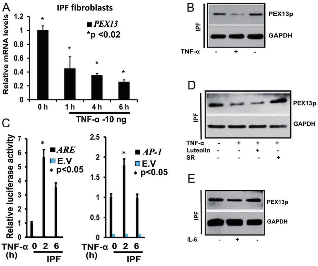 Fig. 27. TNF-α downregulates peroxisome biogenesis by induction of AP1 in human IPF fibroblasts.