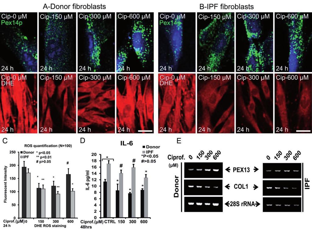 Fig. 30. PPAR- agonist ciprofibrate induces peroxisome proliferation, decreases fibrotic markers COL1 and reduces ROS and IL-6 levels in control and IPF fibroblasts.