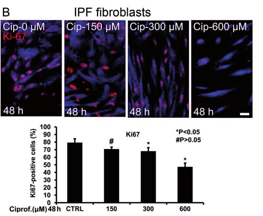 Therefore, we speculated that this inhibition of proliferation might contribute to the alleviation of fibrosis progression by blocking fibroblast/myofibroblast