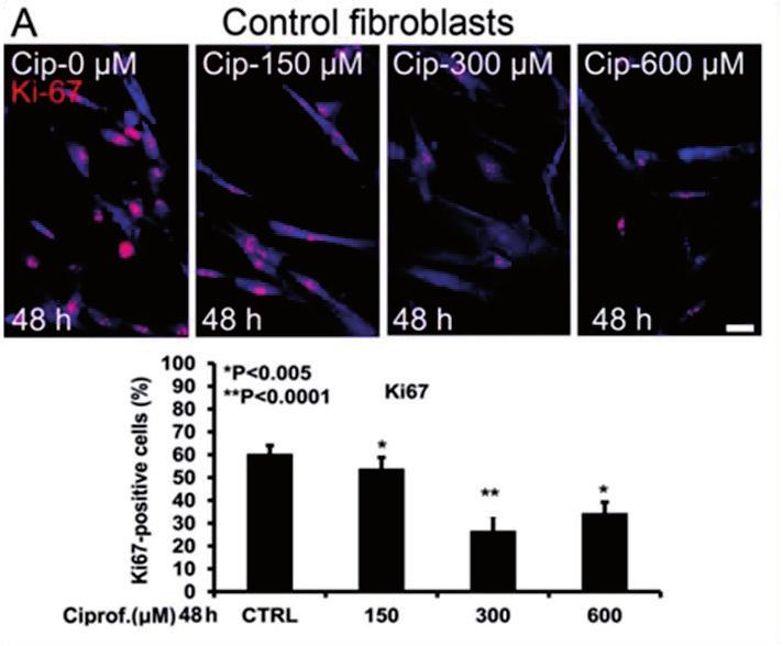 Confluent control and IPF fibroblasts were treated with ciprofibrate with indicated concentrations and times.