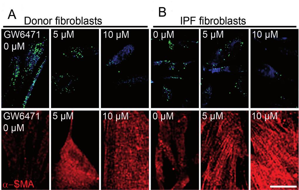 3.12. PPAR- inhibitor GW6471 blocks peroxisome proliferation and promotes myofibroblast differentiation as well as ROS release in control and IPF fibroblasts In order to further investigate whether