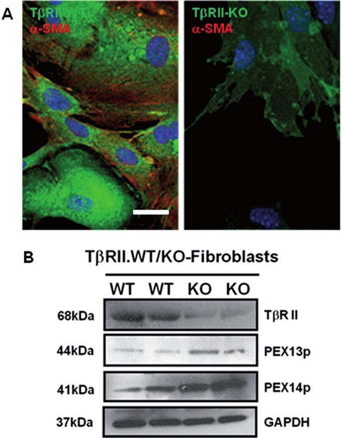 Fig. 36. Upregulation of peroxisomal proteins in T RII knockout mice. (A) Double immunofluorescence staining of T RII with -SMA in wild-type and T RII knockout lung fibroblasts.