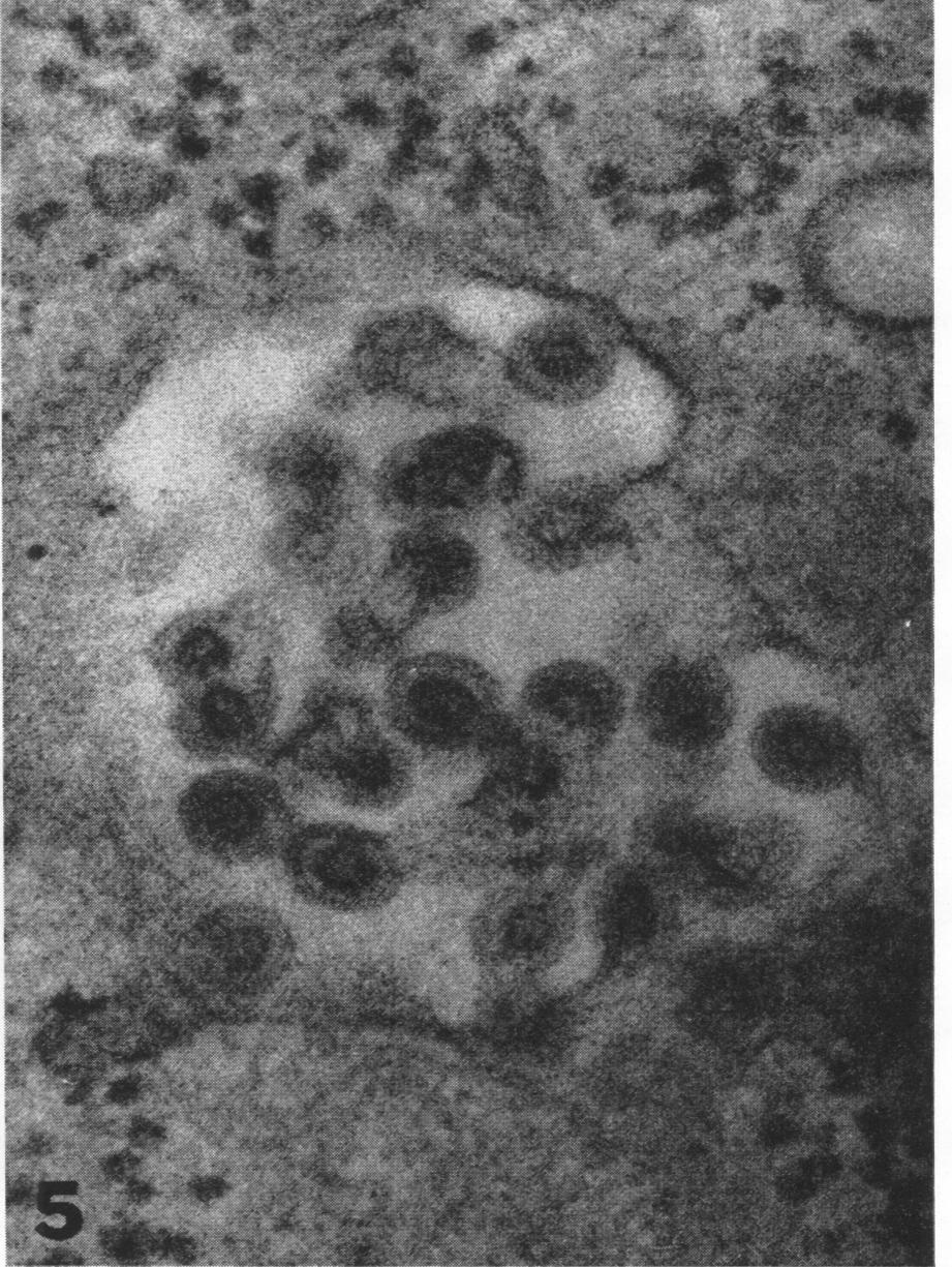 Membrane appears contiguous with outer layer of virus particle. X 178,000. FIG. 5.