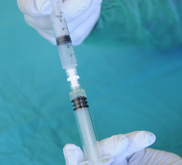 4 Hold the two syringes near vertically; with the syringe containing the DAC powder inferiorly.
