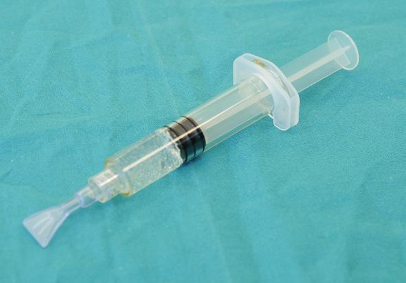 Transfer the gel several times from one syringe to the other until a homogenous gel is formed. Leave the gel loaded syringe to rest for 5-10 minutes before use.