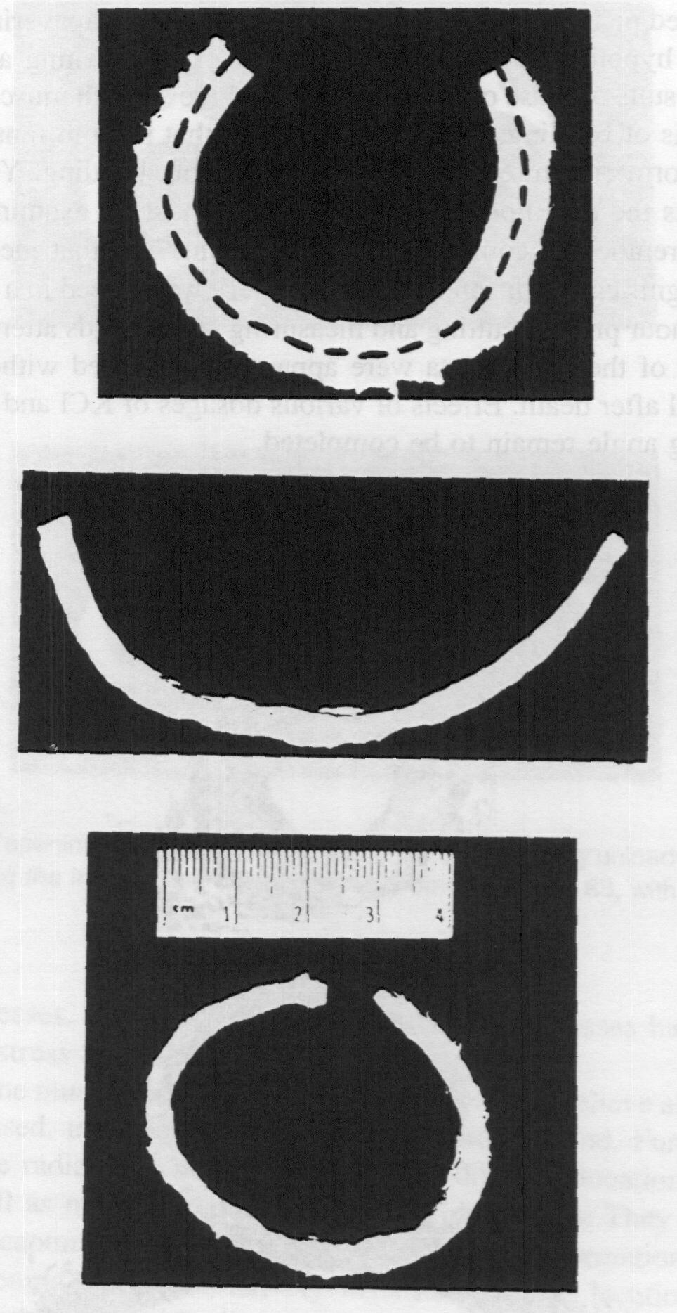Residual Strain The opening-up (right) of originally unloaded intact arterial ring (left) following a radial cut (from Fung, 1984) Opening Angles A B C Adventitia is the origin of the