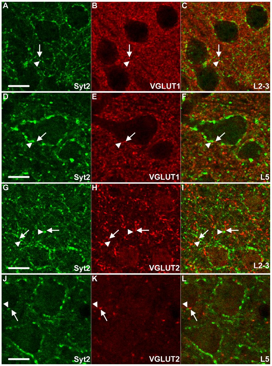 Synaptotagmin-2 Labels Parvalbumin+ Boutons Figure 5. Quantification of colocalization of Syt2 and markers for specific subsets of inhibitory and excitatory neurons.