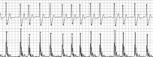 Assessment of ECG frequency and morphology parameters 711 ECG DATASET (10 S