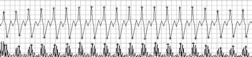 The detected significant peaks in both traces are marked with asterisks.