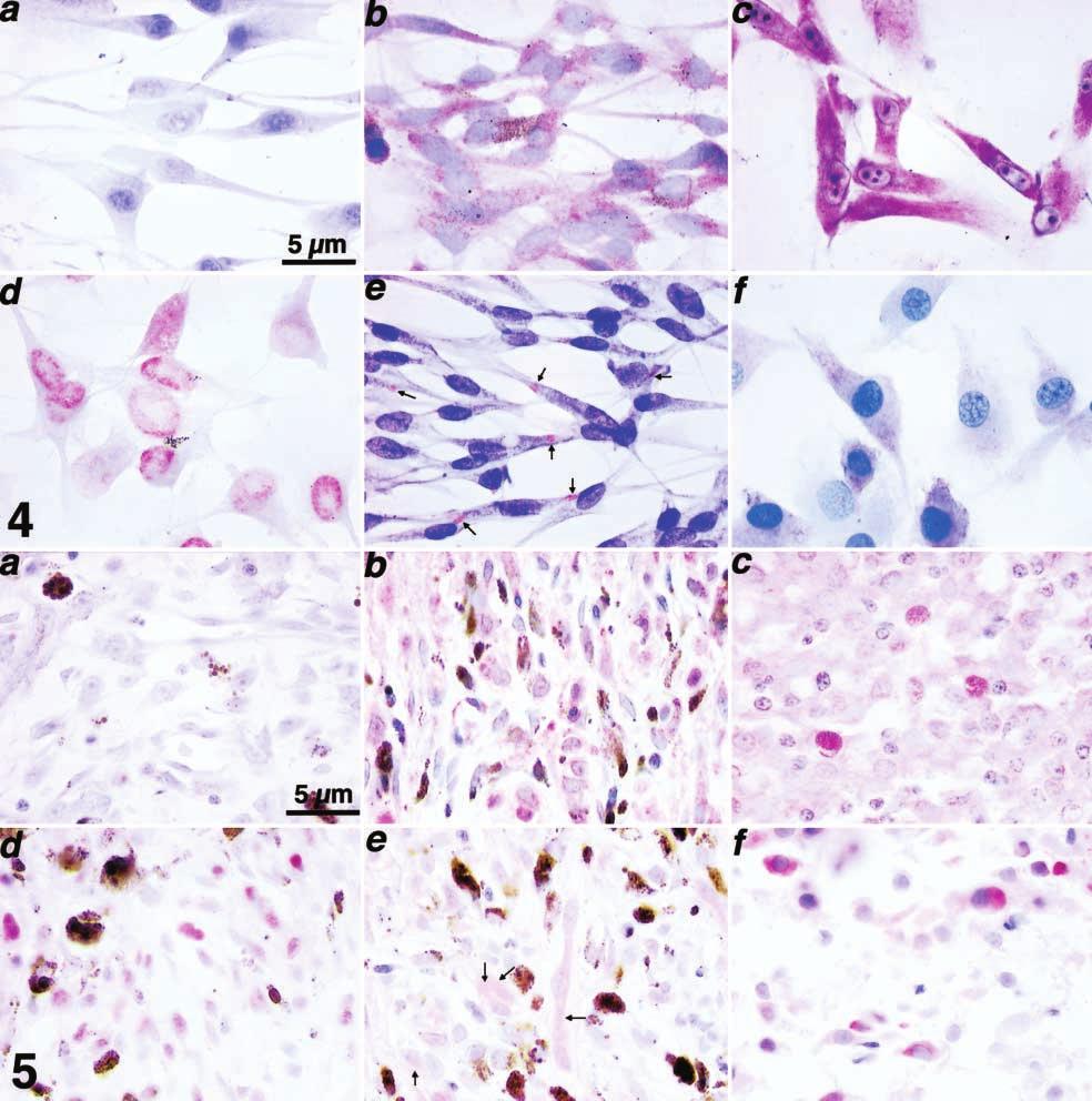 Vet Pathol 39:4, 2002 Tumor Suppressors in Canine Melanoma 463 Fig. 4. Immunoytohemial assessment of the expression and aumulation patterns for p53, p21, Rb, p16, and PTEN in anine melanoma ell lines.