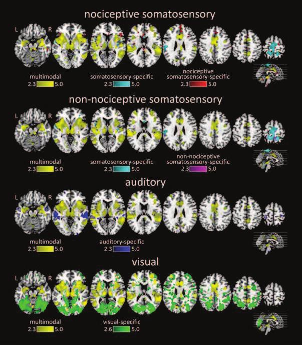 CHARACTERIZING THE CHANGES IN CORTICAL EXCITABILITY AND FUNCTIONAL CONNECTIVITY INDUCED BY SUSTAINED EXPERIMENTAL PAIN AND CHRONIC PATHOLOGICAL PAIN G. Huang, E. Van Den Broeke, G. Liberati, A.