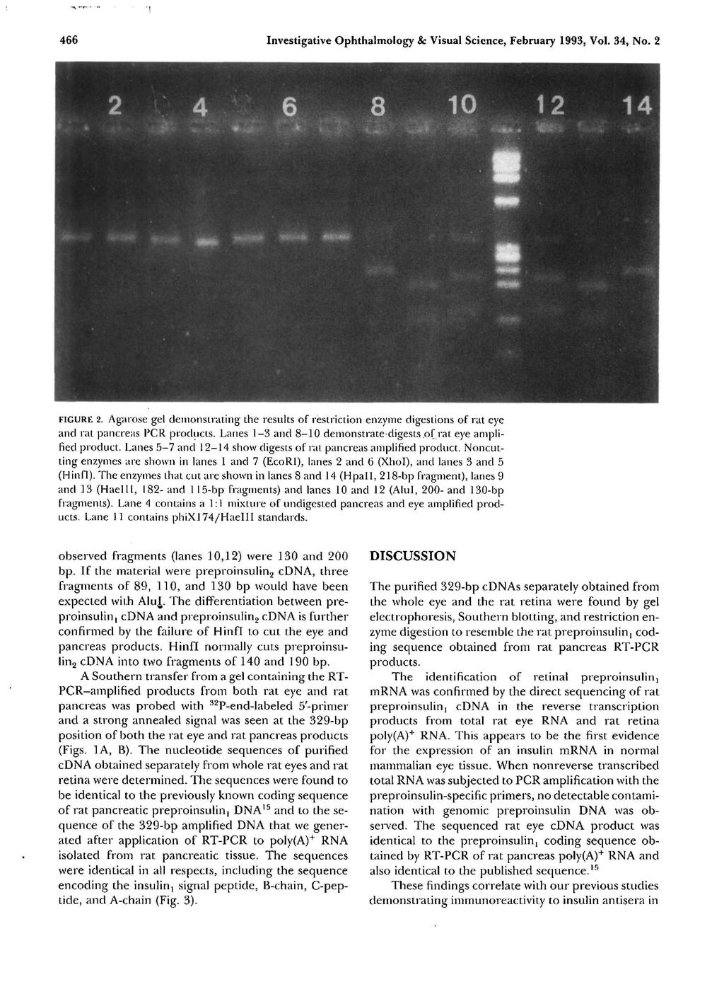 466 Investigative Ophthalmology 8c Visual Science, February 1993, Vol. 34, No. 2 FIGURE 2.