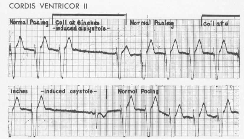 FURMAN, PARKER, KRAUTHAMER, AND ESCHER FG. 1. This pacemaker is designed to respond to external stimuli in order to modify its function.