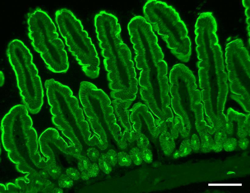 Villin, an actin bundler in intestinal microvilli Villin Restricted cellular