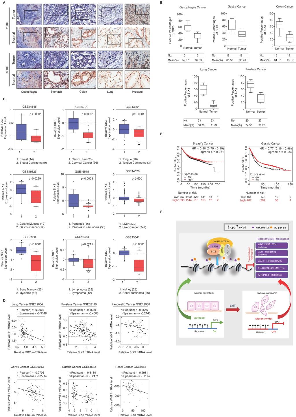 987 Figure 7. SIX3 is Downregulated in Multiple Carcinomas and Positively Correlated with Better Prognosis (A, B) SIX3 is downregulated in multiple carcinomas.