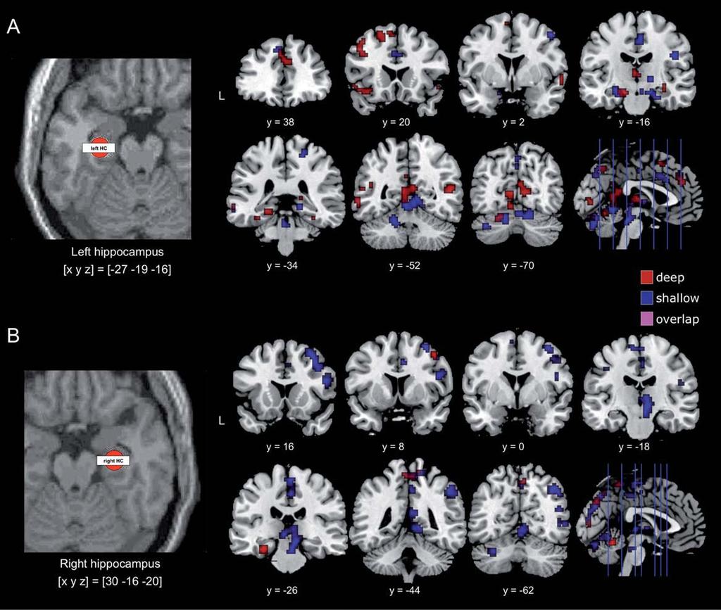 r Hippocampal Cortical Connectivity During Memory Formation r Functional connectivity of the left and right hippocampus related to successful episodic memory encoding in the deep and shallow study