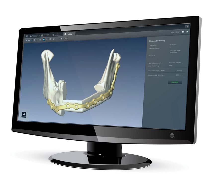 Customized Mandible Workflow Within the design session, the surgeon can interface with a design engineer using the proprietary BluePrint software to select specific plate design