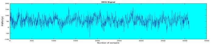 59 Manisha Chandani and Arun Kumar: Statistical Wavelet Features, PCA, MLPNN, SVM and K-NN Based Approach for the Classification of EEG Physiological Signal The cerebrum is the largest part and is