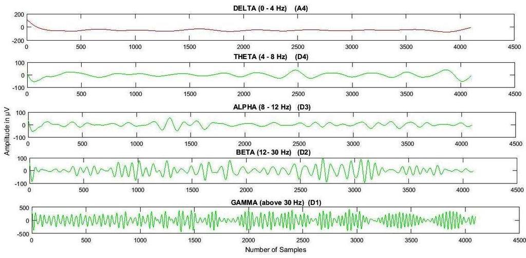 Normal EEG Signal with Delta, Theta, Alpha, Beta and Gamma