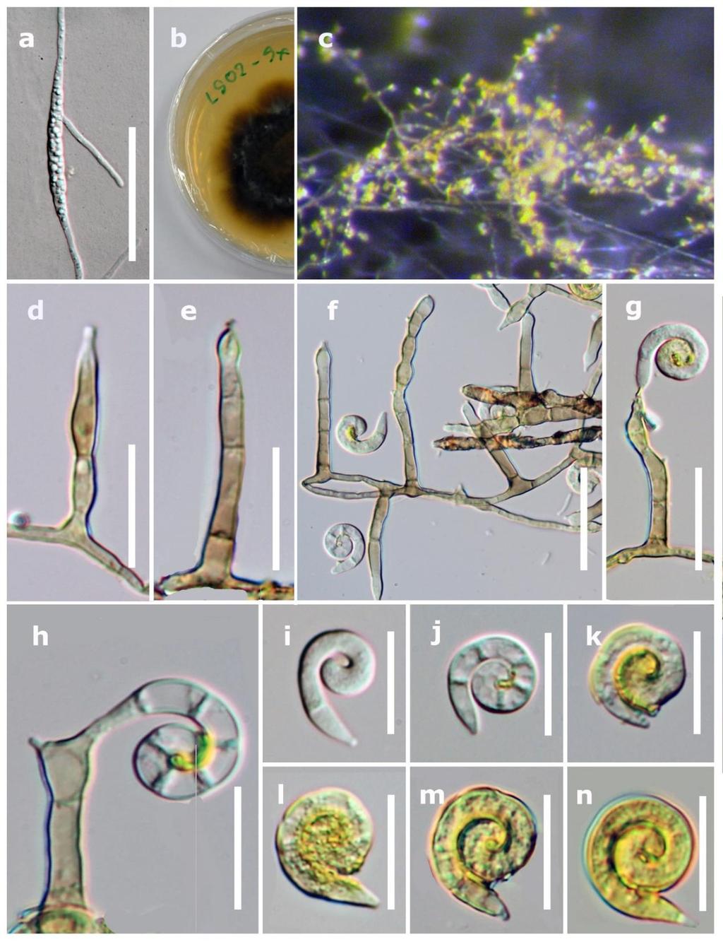 Fig. 7 Helicosporium flavum on MEA culture (MFLU 17-0704, holotype). a Germinating ascospore. b Culture on MEA from surface. c Colony on MEA.