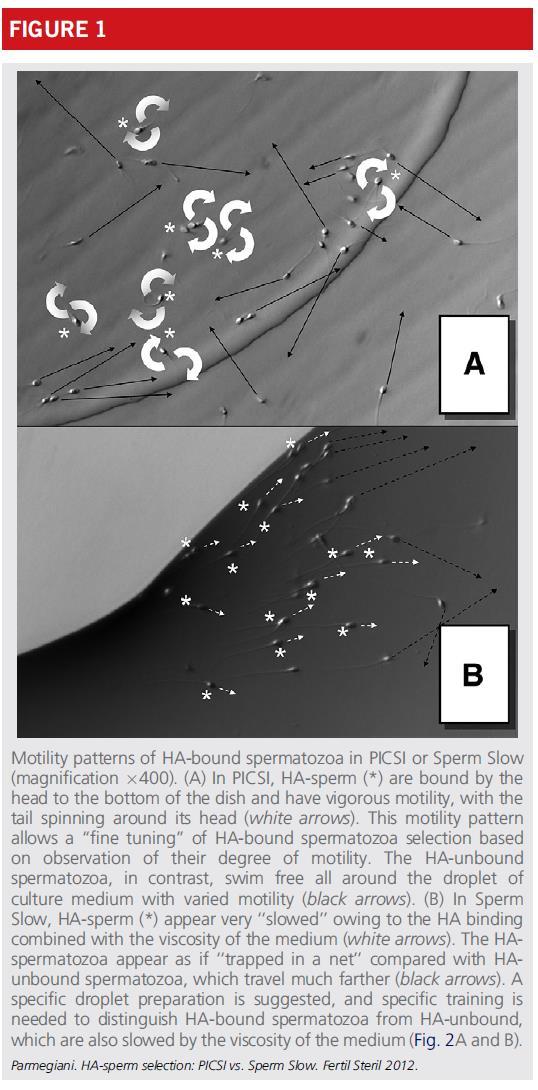 Physiologic HA-ICSI - Potential benefits HA-spermatozoa show: significant reduction in DNA fragmentation improvement in nucleus normalcy at High Magnification Parmegiani et al, Fertil Steril 2010